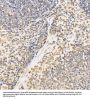 Protein SSXT (SS18) Antibody