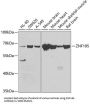 Zinc Finger Protein 195 (ZNF195) Antibody