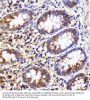 Ubiquitin-Like-Conjugating Enzyme ATG10 (ATG10) Antibody