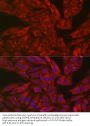Gasdermin E (GSDME) Antibody