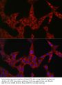 Gasdermin E (GSDME) Antibody