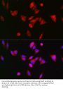 Bile Acid-CoA:amino Acid N-Acyltransferase (BAAT) Antibody