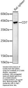 T-Cell Antigen CD7 (CD7) Antibody