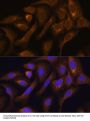 Serine Hydroxymethyltransferase, Cytosolic (SHMT1) Antibody