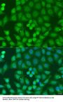 Zinc Finger FYVE Domain-Containing Protein 16 (ZFYVE16) Antibody