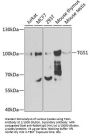 Trimethylguanosine Synthase 1 (TGS1) Antibody