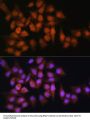 Bisphosphoglycerate Mutase (BPGM) Antibody