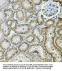 Cadherin 16 (CDH16) Antibody