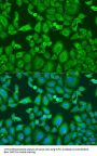 Kinesin Family Member 11 (KIF11) Antibody