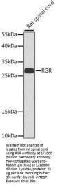 RPE-Retinal G Protein-Coupled Receptor (RGR) Antibody