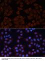 ADAM Metallopeptidase Domain 12 (ADAM12) Antibody