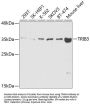 Tribbles Homolog 3 (TRIB3) Antibody