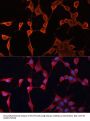 DnaJ (Hsp40) Homolog, Subfamily A, Member 2 (DNAJA2) Antibody