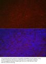Leukocyte Immunoglobulin Like Receptor Subfamily B Member 4 (LILRB4) Antibody