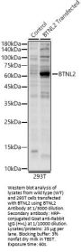 Butyrophilin-Like Protein 2 (BTNL2) Antibody