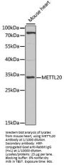 Methyltransferase-Like Protein 20 (METTL20) Antibody