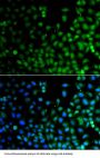 LIM/Homeobox Protein Lhx6 (LHX6) Antibody