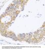 Mitogen-Activated Protein Kinase Kinase Kinase MLT (ZAK) Antibody