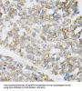 Mitogen-Activated Protein Kinase Kinase Kinase MLT (ZAK) Antibody