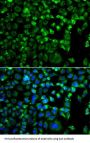 Mitogen-Activated Protein Kinase Kinase Kinase MLT (ZAK) Antibody