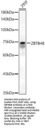 Zinc Finger And BTB Domain-Containing Protein 48 (ZBTB48) Antibody