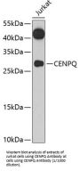 Centromere Protein Q (CENPQ) Antibody
