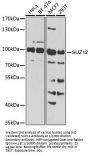 Polycomb Protein SUZ12 (SUZ12) Antibody