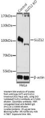 Polycomb Protein SUZ12 (SUZ12) Antibody