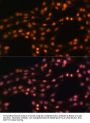 Polycomb Protein SUZ12 (SUZ12) Antibody