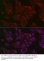 Signal Transducer And Activator of Transcription 3 (STAT3) Antibody