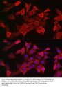 Signal Transducer And Activator of Transcription 3 (STAT3) Antibody