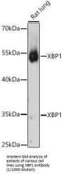 X-Box-Binding Protein 1 (XBP1) Antibody