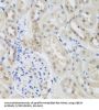Ubiquitin Protein Ligase E3A (UBE3A) Antibody