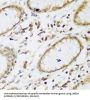 Ubiquitin Protein Ligase E3A (UBE3A) Antibody