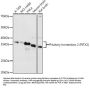 Pituitary Homeobox 2 (PITX2) Antibody