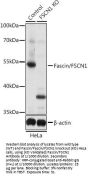 Fascin (FSCN1) Antibody