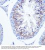 Fascin (FSCN1) Antibody