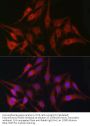 Fascin (FSCN1) Antibody