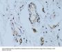 Melanoma Cell Adhesion Molecule (MCAM) Antibody