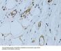 Melanoma Cell Adhesion Molecule (MCAM) Antibody