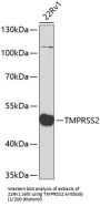 Transmembrane Protease, Serine 2 (TMPRSS2) Antibody