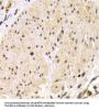 Transmembrane Protease, Serine 2 (TMPRSS2) Antibody