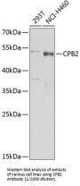 Carboxypeptidase B2 / TAFI (CPB2) Antibody