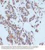 Apoptosis-Stimulating of p53 Protein 2 (TP53BP2) Antibody