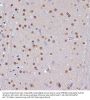 Apoptosis-Stimulating of p53 Protein 2 (TP53BP2) Antibody