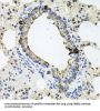 Receptor Tyrosine-Protein Kinase ErbB-4 (ERBB4) Antibody