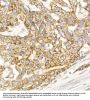 Glycerol Kinase (GK) Antibody