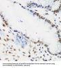 Krueppel-Like Factor 4 (KLF4) Antibody