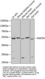 Receptor Associated Protein of The Synapse (RAPSN) Antibody