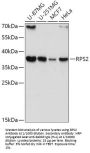 Ribosomal Protein S2 (RPS2) Antibody